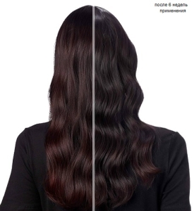 Redken          300 